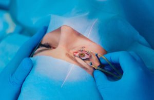 Laser Eye Surgery Vietnam surgery Laser Eye Surgery Vietnam surgery