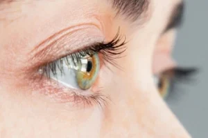 Cataracts Surgery eyesight Cataracts Surgery eyesight