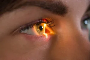 can laser eye surgery fix astigmatism check can laser eye surgery fix astigmatism check
